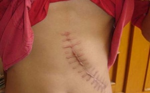 Góc khuất đằng sau lời 'rao mình' trong 'ma trận'... chợ thận online