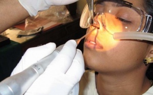 Viêm xoang 5 năm có nên phẫu thuật?