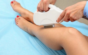 Có hay không chuyện tẩy lông bằng laser gây vô sinh, ung thư?