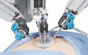 Quá trình phẫu thuật cắt túi mật diễn ra như thế nào?