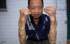 Có thể nhận biết nhiễm độc chì bằng mắt thường?