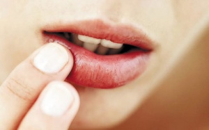 Môi bị ngứa, sưng lên là bệnh gì?