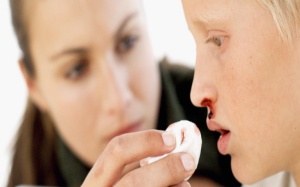 Tại sao chảy máu cam tuyệt đối không được ngửa đầu ra sau?