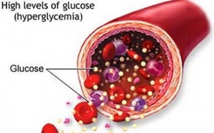 Nắng nóng, cảnh báo nguy cơ với bệnh đái tháo đường