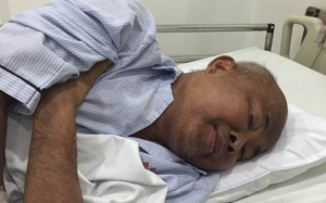 Sức khỏe nghệ sỹ Hán Văn Tình ngày càng yếu, mặt sưng phù