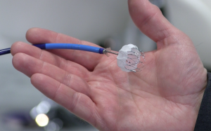 Giảm nguy cơ đột quỵ bằng thiết bị cấy ghép