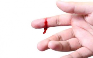 Các bước để xử lý vết thương ngay tại nhà?