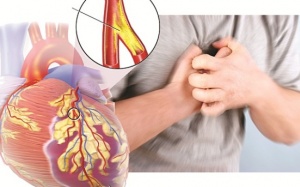 Điều trị bệnh mạch vành như thế nào?