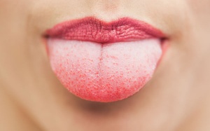 Màu sắc của lưỡi cảnh báo bệnh tật