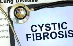 7 Triệu chứng chính của bệnh xơ nang