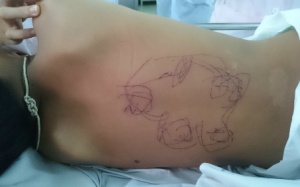 Bé trai bị rạch dao lam để vẽ bùa chữa viêm não Nhật Bản