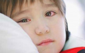 Bé 3 tuổi bị hỏng mắt vì mẹ thích sành điệu: Bài học cho nhiều gia đình