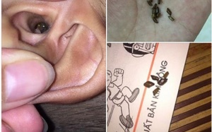 Chơi xúc cát, bé 4 tuổi suýt bị thủng màng nhĩ