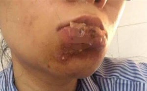 Gây tai biến, một cơ sở làm đẹp  trốn thanh tra