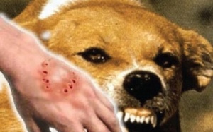 Cách sơ cứu và điều trị khi trẻ bị chó cắn