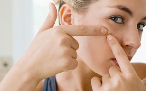 Mụn đầu đen mọc 'kín mặt' vì những nguyên nhân không ngờ!