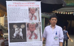 Bác sỹ ra chợ xin từ thiện cứu 2 bé song sinh dính liền: Bị trách nhưng vẫn vui