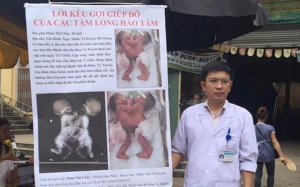 Vụ cặp song sinh dính liền: Bộ trưởng Bộ Y tế vào cuộc!