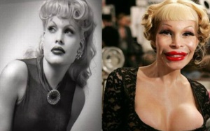 Thèm khát phẫu thuật thẩm mỹ tố cáo bạn mắc căn bệnh này