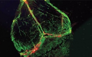 Phát hiện mạch bạch huyết chưa từng thấy trong não người