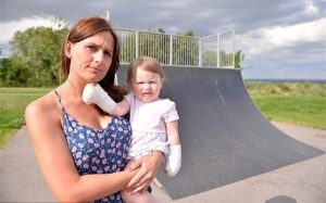 Bé gái 1 tuổi bị bỏng nặng khi chơi trong công viên vì trời quá nắng