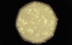 Thử nghiệm tế bào gốc: Hy vọng mới cho bệnh tim mạch