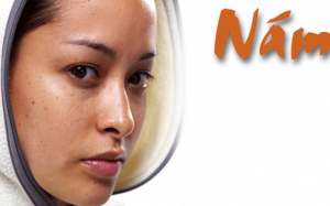 Vì sao phụ nữ 35+ hay bị nám da?