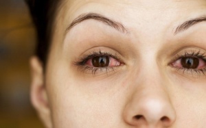 15 nguyên nhân khiến mắt bạn bị đỏ thường xuyên