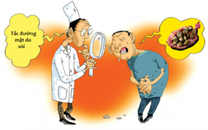 Các triệu chứng của bệnh túi mật: Đừng xem nhẹ mà nguy!