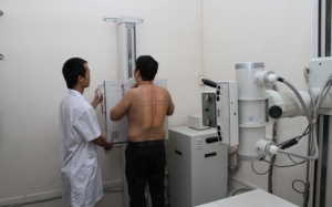 Chụp X-quang ảnh hưởng gì đến sức khỏe?