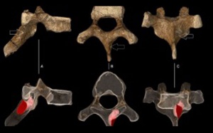 Tìm thấy dấu vết bệnh ung thư trong hóa thạch gần 2 triệu năm 