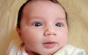 Dấu hiệu nhận biết trẻ bị lác mắt