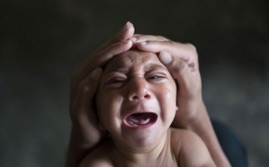 Virus Zika ở Việt Nam ít có khả năng gây dị tật đầu nhỏ cho trẻ sơ sinh