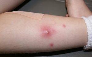 Con bị nhiễm vi khuẩn cực độc từ trò chơi nhà phao: Cách xử lý đáng học tập của bà mẹ