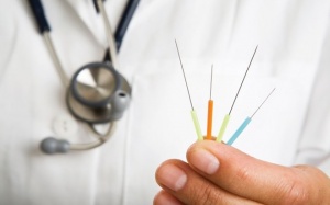 Châm cứu giúp cải thiện trí nhớ cho người đãng trí