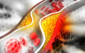 Cholesterol tốt: Thừa hay thiếu đều có thể gây tử vong sớm