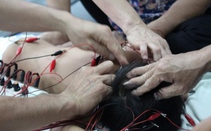 Những chiếc kim 'thần kỳ' khiến người câm biết nói, trẻ bị liệt biết đi