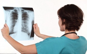 Cảnh giác với “thủ phạm” tàn phá lá phổi ngay trong nhà!