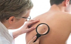 Những dấu hiệu ung thư ít để ý nhất