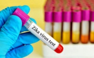 Zika - Những nguy cơ còn ít người biết đến