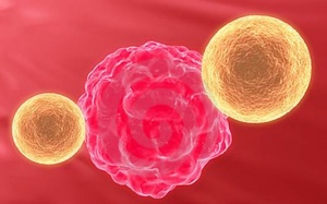 Béo phì có nguy cơ cao bị 8 loại ung thư