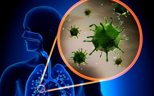 Những điều bạn cần biết về bệnh viêm phổi