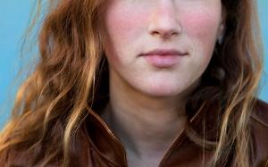 Làm sao để ứng phó với bệnh lupus ban đỏ?