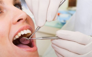 Có nên nhổ răng khôn?