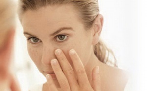 Mẹ sau sinh chả việc gì phải sợ nám!