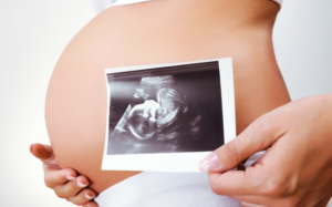 Thai nhi to hơn so với tuổi thai: Cả mẹ và bé đều gặp nguy!