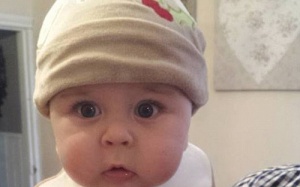 Bé 14 tháng tuổi bị nhiễm virus Herpes cả đời vì bị người lạ hôn