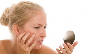 Bí quyết giúp bạn đối phó với vết sẹo mụn trứng cá