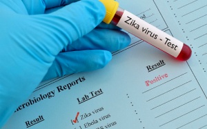 Xét nghiệm miễn phí virus Zika ở 30 bệnh viện TP HCM