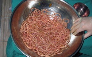 Đừng để giun sán làm tổ trong cơ thể chỉ vì tiếc 20.000 đồng